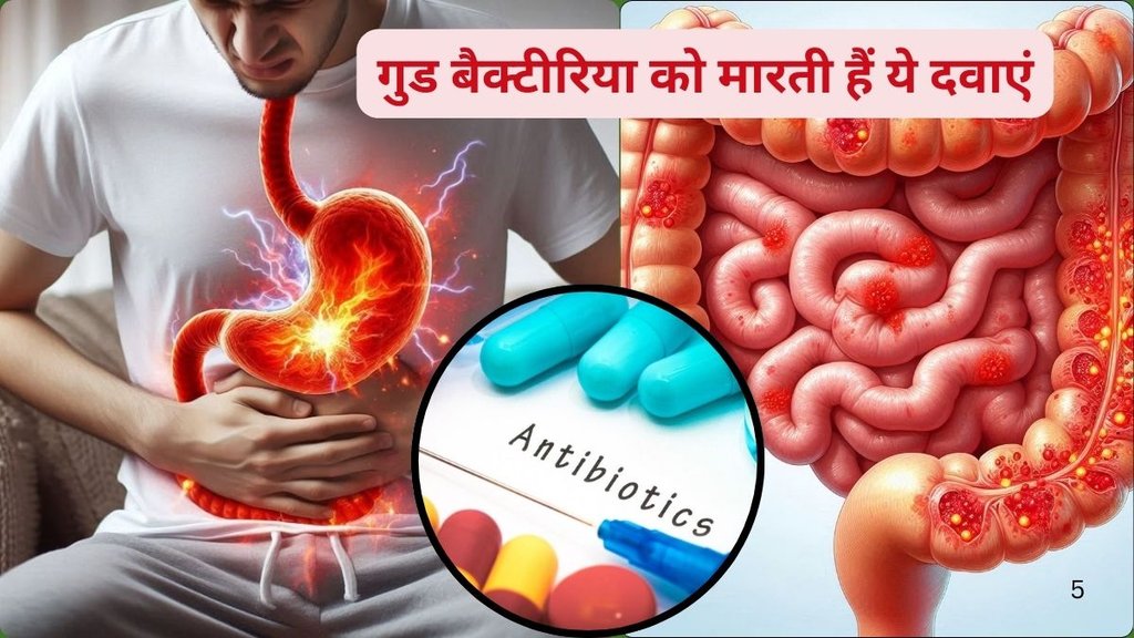 fermented foods,prebiotic foods,gut health,