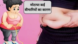 मोटापा, शुगर-BP ही नहीं इन बीमारियों को भी देता है न्योता, एक्सपर्ट ने बताया कारण और उपचार