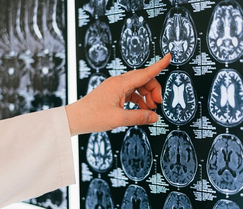 Alcohol and the Brain