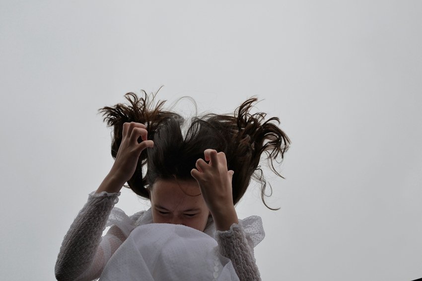 Amla for Hair Care Benefits Side Effects and Precautions