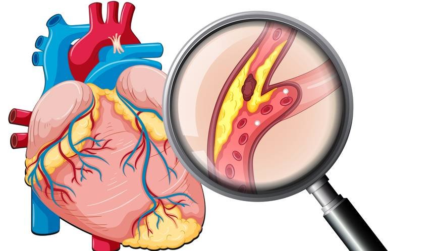 Natural remedies for heart health