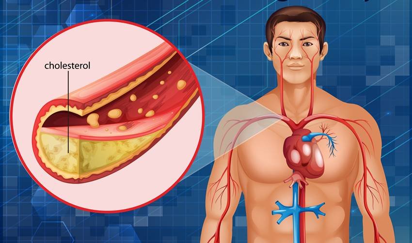 Natural heart care