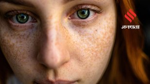 Avoid these skin habits