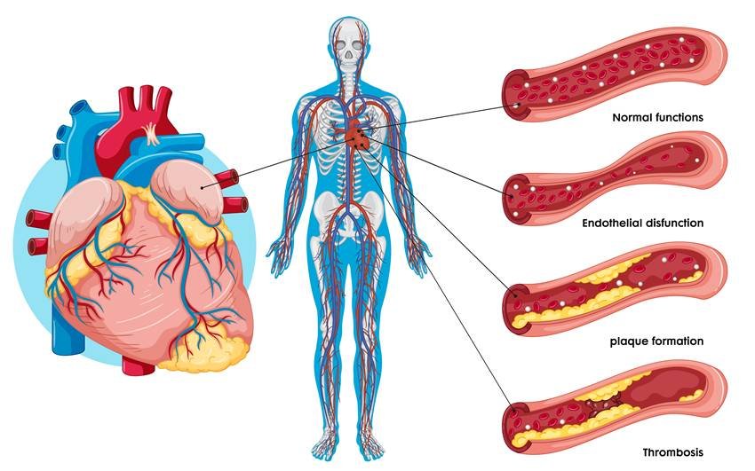 natural ways to keep heart healthy