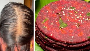 Best Recipe to Stop Hair fall | food to Increase Hair Growth | Beetroot-amla chilla recipe