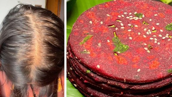 Best Recipe to Stop Hair fall | food to Increase Hair Growth | Beetroot-amla chilla recipe
