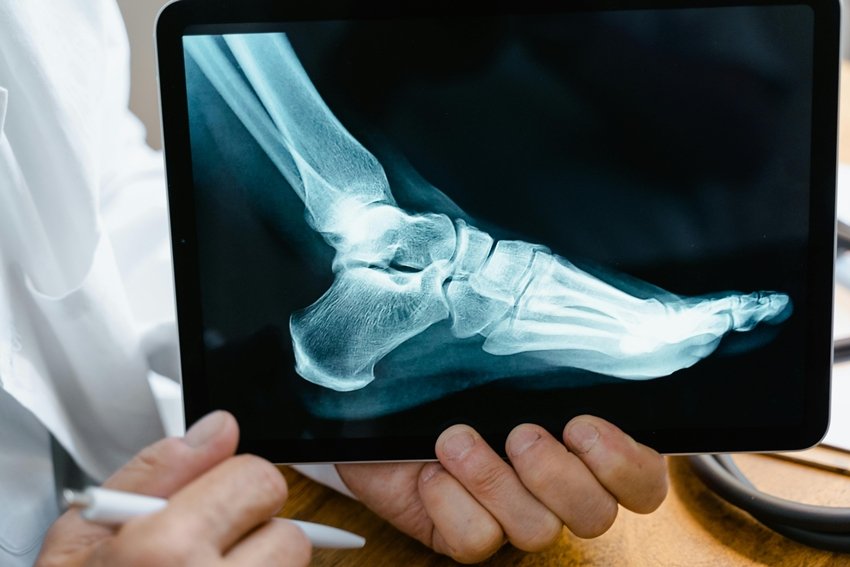 Daily Heel Pain Explained