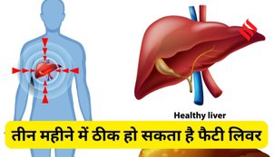 Fatty Liver diet plan
