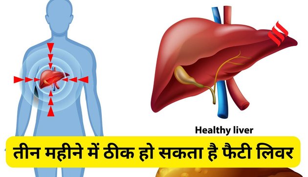 Fatty Liver diet plan