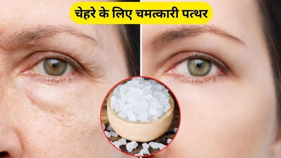 Fitkari face pack, Fitkari face pack benefits, Fitkari face pack how to use