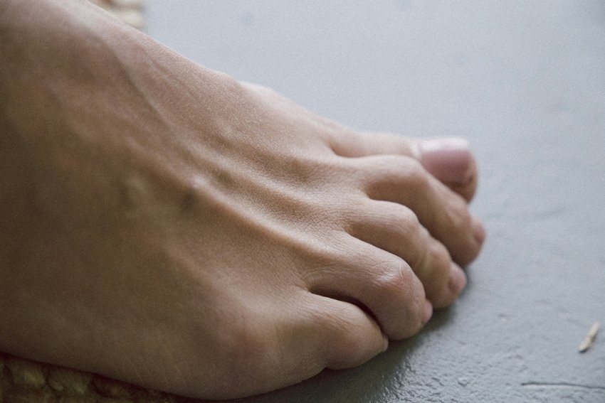 Hidden Causes of Constant Heel Pain