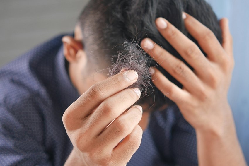 Hidden Reason Behind Hair Thinning