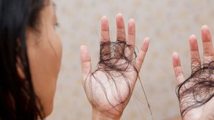 How To Stop Hair Fall | What to eat to stop hair fall naturally | Food for hair growth