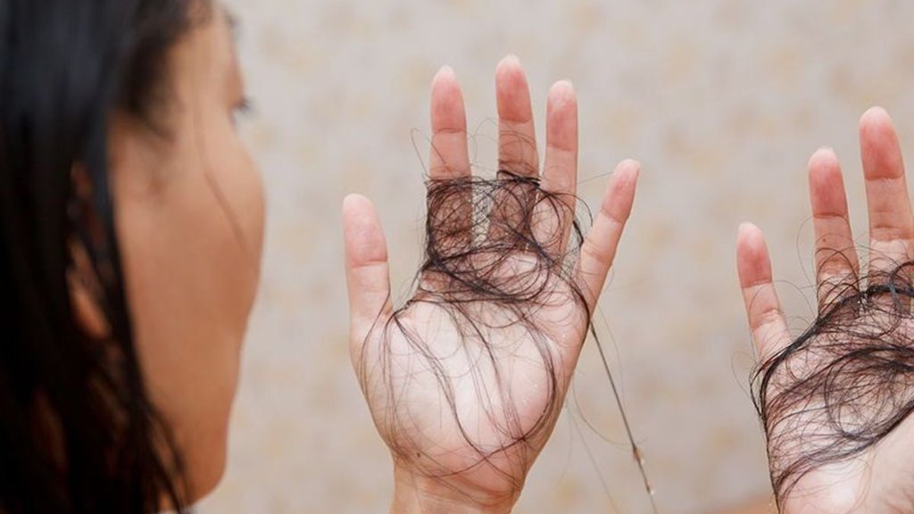 How To Stop Hair Fall | What to eat to stop hair fall naturally | Food for hair growth