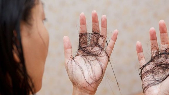 How To Stop Hair Fall | What to eat to stop hair fall naturally | Food for hair growth