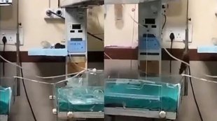 Indore hospital news, biting newborns