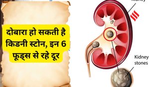 Kidney stone Diet