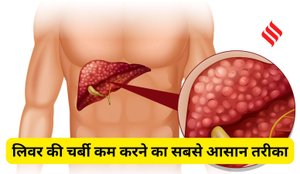 Foods to reduce liver fat