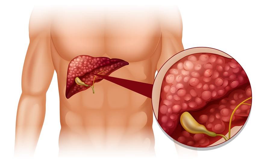 liver detox foods