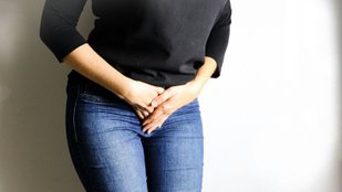 PCOS treatment options