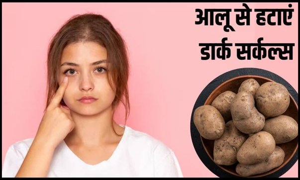Potatoes for Dark Circles, aalu se dark circle kaise hataye, how to use potato for dark circles