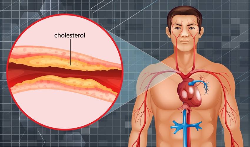  lower cholesterol in 30 days