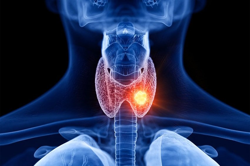 Superfoods for Thyroid Healing