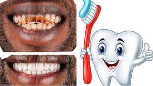Tambaku Gutkha Ke daant saaf karne ka tarika | teeth whitening | Home Remedies for Yellow Teeth