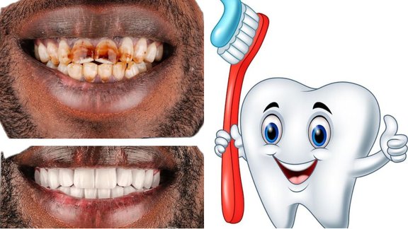 Tambaku Gutkha Ke daant saaf karne ka tarika | teeth whitening | Home Remedies for Yellow Teeth