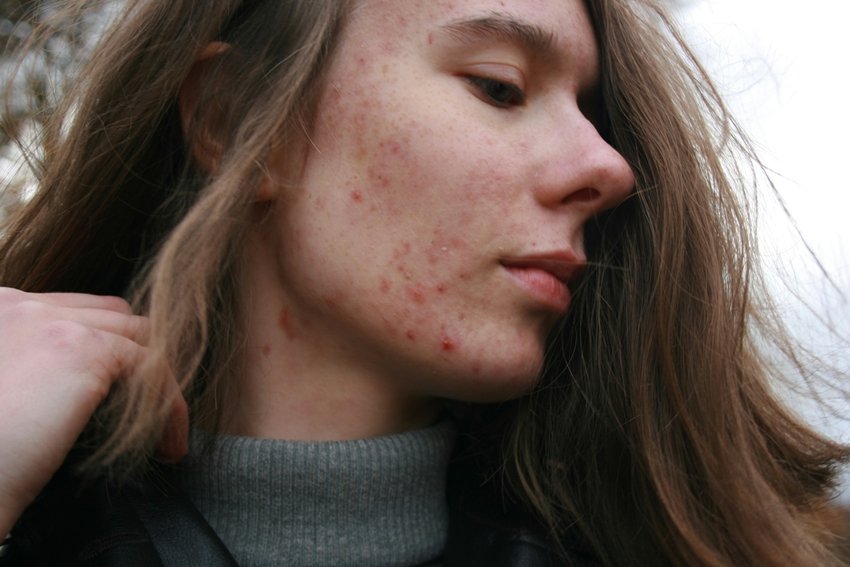 Want Glowing Skin Stop These Common Mistakes Now