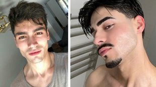 Ways to Get Chubby Cheeks | Best foods for boys | how to fix Sunken Cheeks