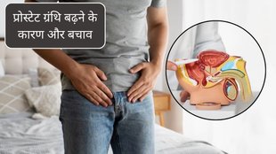 benign prostatic hyperplasia, prostate enlargement, urinary issues, urologist, signs of prostate enlargement, Benign Prostatic Hyperplasia-BPH, prostatic hyperplasia