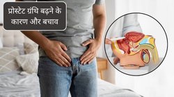 ज्यादा पानी नहीं पीते, फि‍र भी बार-बार आता है यूरिन, पुरुषों में प्रोस्टेट बढ़ने के दिखते हैं 5 लक्षण, यूरोलॉजिस्ट ने बताए बचाव