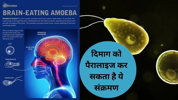 kerala amoeba virus, kerala amoeba case, kerala amoeba symptoms, kerala amoeba death, kerala amoebanews, kerala amoeba treatment, kerala amoeba, brain eating disease,