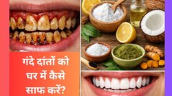 तंबाकू और गुटखा खाने से दांत हो गए हैं लाल-पीले तो साफ करने के लिए आजमाएं ये घरेलू उपाय