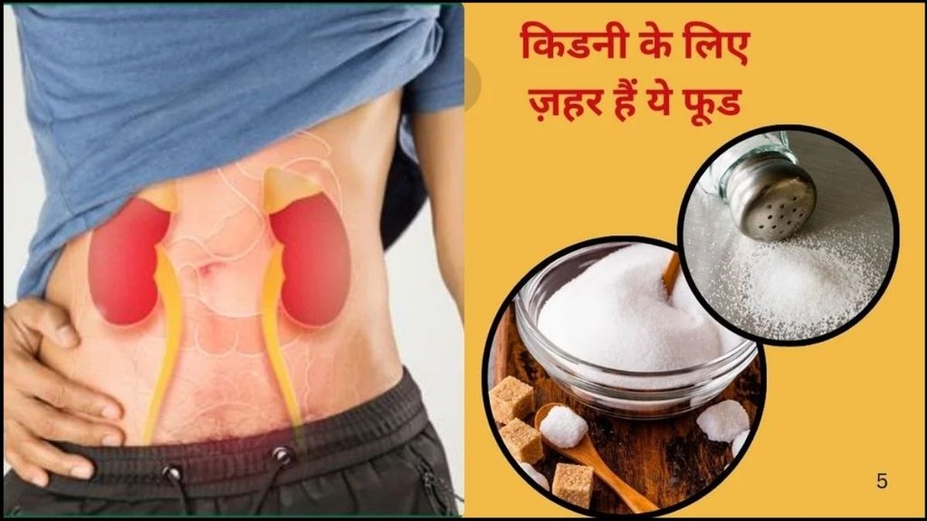 kidney stones diet foods, kidney stones symptoms signs causes and remedies, remedy for flatulence, kidney stone ke upay, kidney stone symptoms, best diet tips to prevent kidney stones, prevent kidney stones