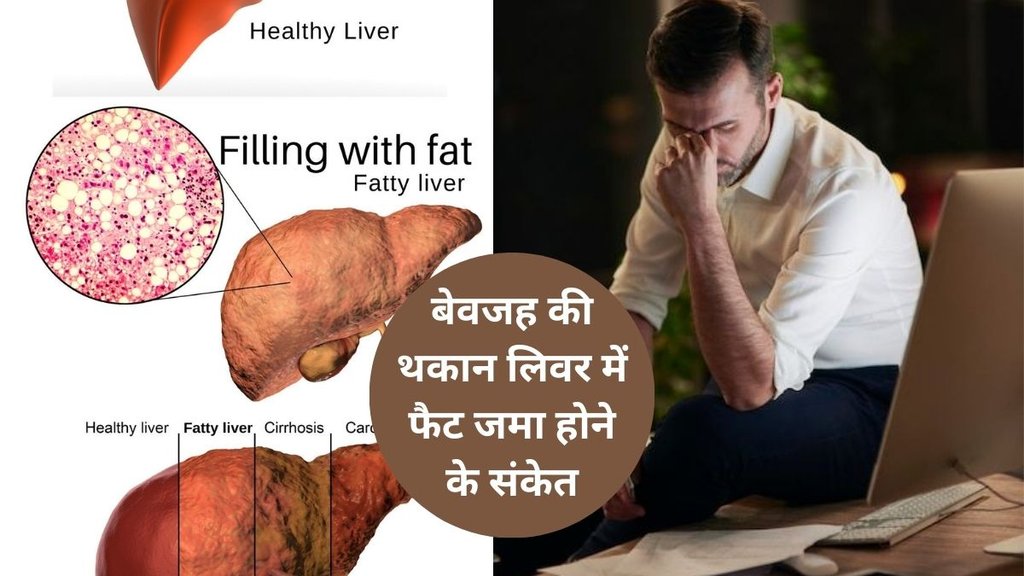 fatty liver, fatty liver signs, fatty liver symptoms, fatty liver disease, fatty liver warning signs, Fatty Liver Symptoms,