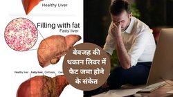 कहीं आपके लिवर पर तो नहीं चढ़ रही खतरनाक चर्बी, 6 लक्षणों में छुपी है Fatty Liver की पहचान, आपको लगे या न लगे सतर्क रहना जरूरी