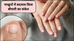 नाखूनों में ये 5 बदलाव बताएंगे सेहत का राज, समय रहते करें पहचान, गंभीर बीमारी के हो जाएंगे शिकार