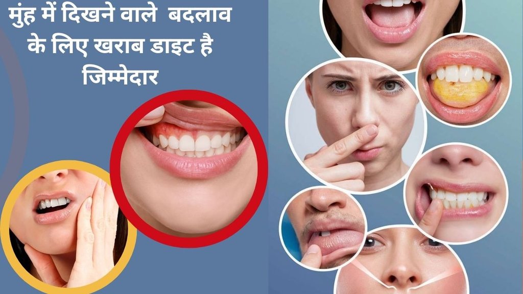 vitamin d,vitamin C deficiency,nutrient deficiencies,mouth symptoms,B vitamin deficiency in lips, vitamin deficiany symptoms on tongue