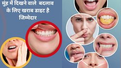 किस विटामिन की कमी से मसूड़ों और जीभ का हो जाता है बंटाधार, होंठ में पड़ने लगती हैं लकीरे, तुरंत जानकर दूर करें परेशानी