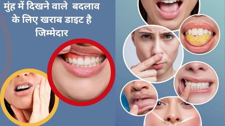 किस विटामिन की कमी से मसूड़ों और जीभ का हो जाता है बंटाधार, होंठ में पड़ने  लगती हैं लकीरे, तुरंत जानकर दूर करें परेशानी