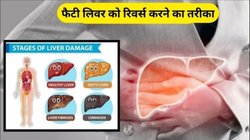 फैटी लिवर को प्राकृतिक रूप से उलट देगा ये खाना, कुछ ही महीनों में 50% तक हो जाएगा सही, स्टडी से हुआ खुलासा