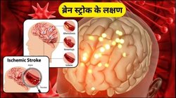 ब्रेन स्ट्रोक अचानक देता है झटका, FAST नियम से तुरंत करें पहचान, इग्नोर करना हो सकता है जानलेवा