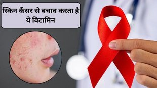 vitamin B3, nuts and seeds, skin cancer, UV rays, Vanderbilt University Medical Center, skin cancer risk factors, why skin cancer occurs, skin cancer in india