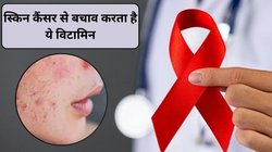 स्किन कैंसर से बचाने में मददगार हो सकता है ये विटामिन, स्टडी में पाया बादाम, काजू और ये बीज बन सकते हैं ढाल