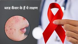 त्वचा पर दिखाते हैं Blood Cancer के ये 3 लक्षण, जिन्हें नजरअंदाज करना हो सकता है खतरनाक