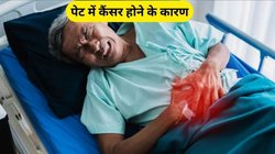 एसिडिटी और पेट फूलना नहीं करें इग्नोर, पेट कैंसर का हो सकता है शुरुआती लक्षण, एक्सपर्ट ने बताए 5 संकेत