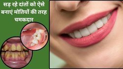 100 साल तक दांत रहेंगे स्ट्रॉन्ग, पीलापन होगा गायब और सांसों की बदबू भी होगी दूर , जानें इस हर्बल मंजन को बनाने का तरीका