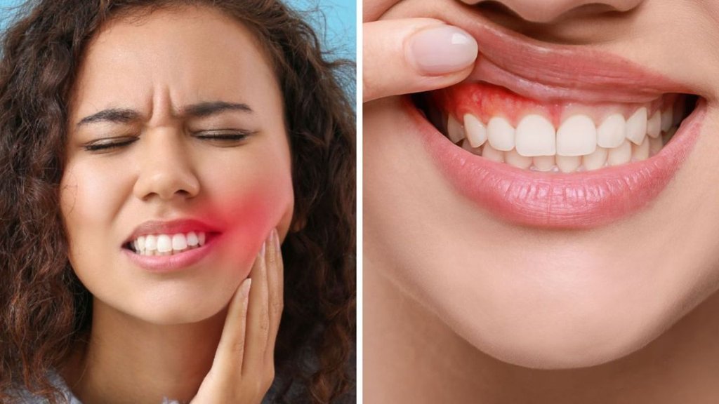 Worst Foods for Your Teeth | Food to Avoid in Toothache | How to stop tooth pain fast